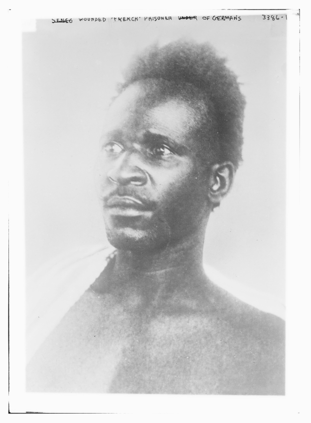 Schwarz-weiß-Foto eines Mannes mit ernstem Gesichtsausdruck, beschriftet mit 'Seneg Verletzter französischer Gefangener unter Deutschen' oben.